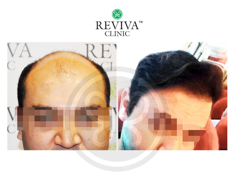 Slider image (3) Reviva Clinic